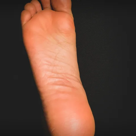 My Dry Cracked Heels Close-Up Set