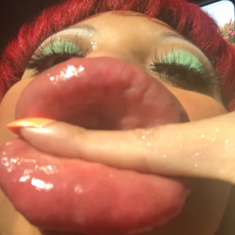 38 Pics From RubyDollLipz's 6 11 24 Lip Fill Appointment
