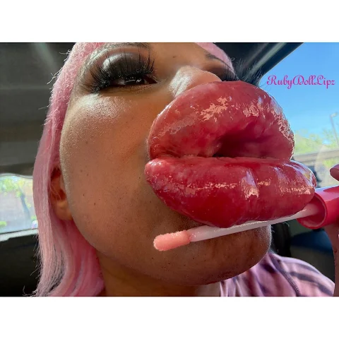 38 Pics From RubyDollLipz's 4 7 26 Lip Fill Appointment