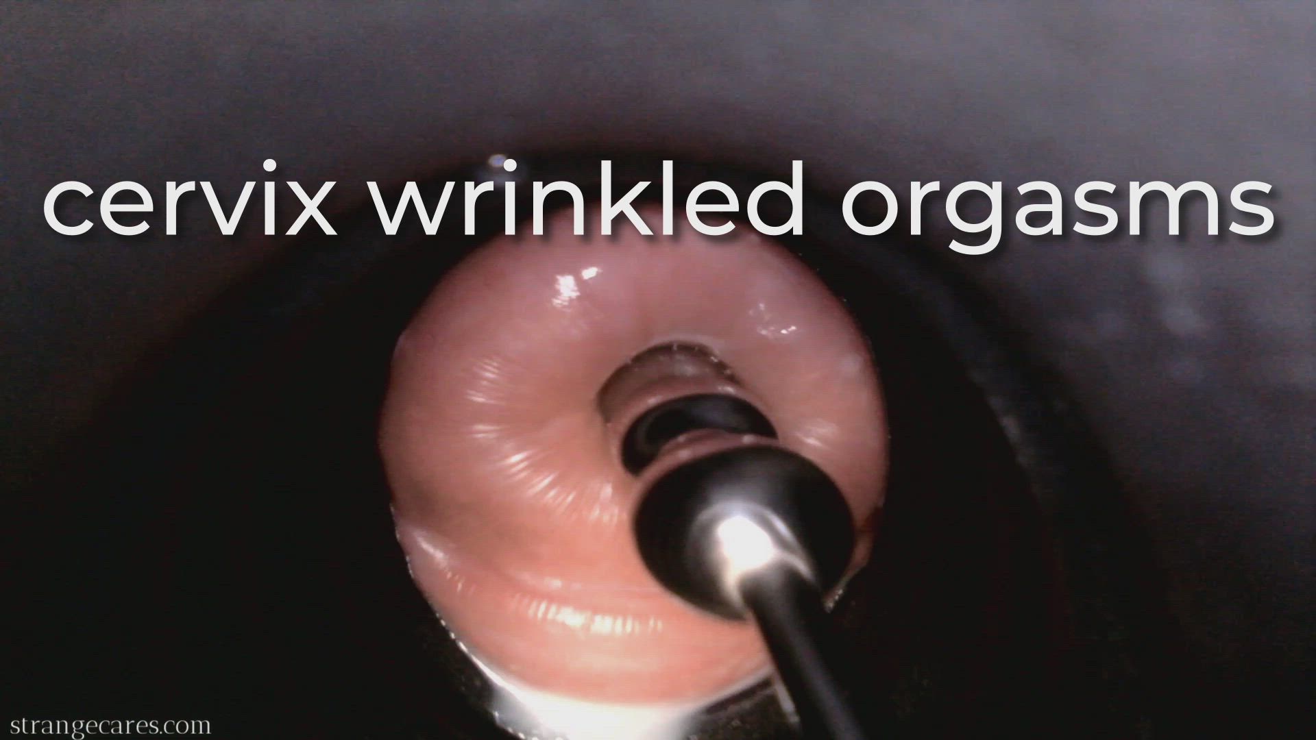 cervix wrinkled orgasms