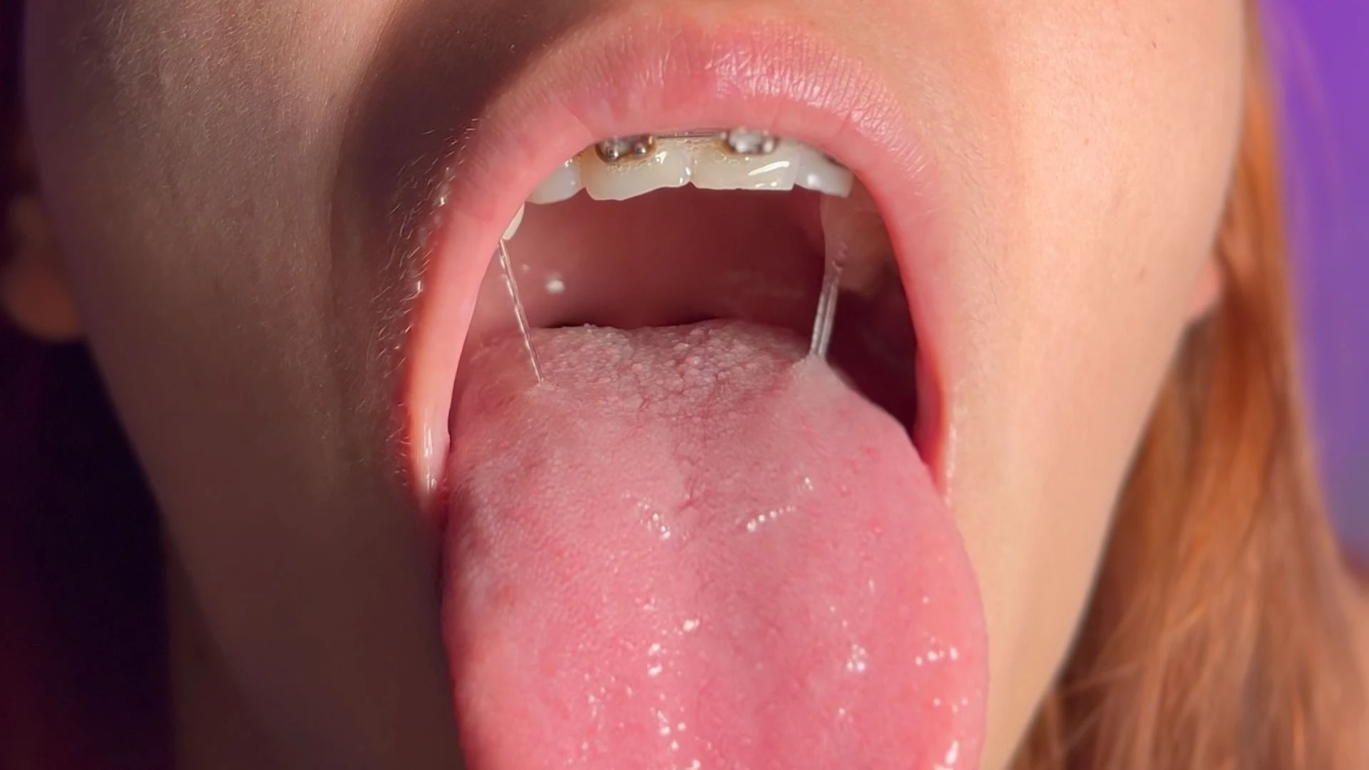 Braces mouth fetish - Tongue Fetish